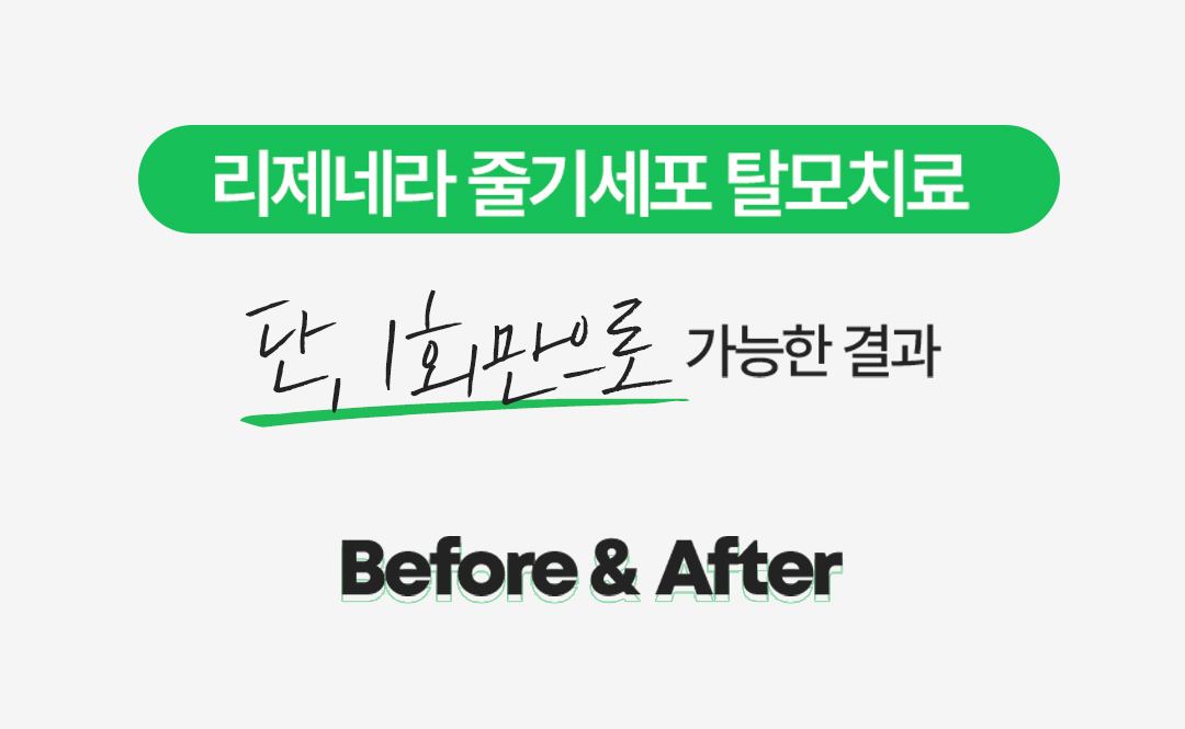 리제네라 줄기세포 탈모치료