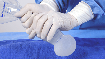 구형구축예방을 위한 감염예방프로토콜 및 수술후 관리프로그램