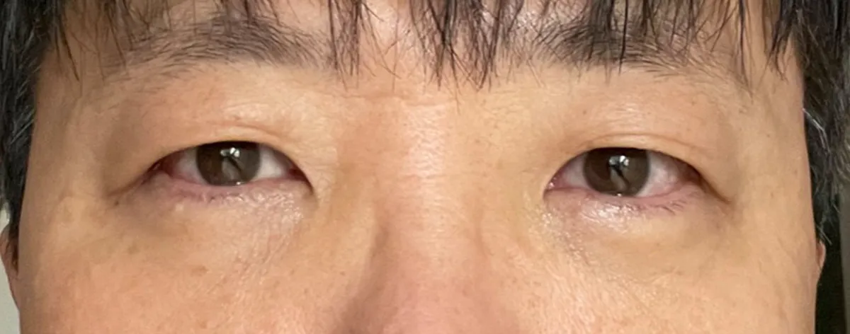 After