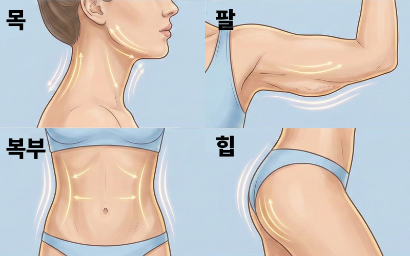 복부, 팔, 목, 힙 등 리뉴비온 적용 부위